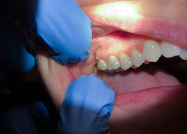 Emergency Dentist Open Today in ND